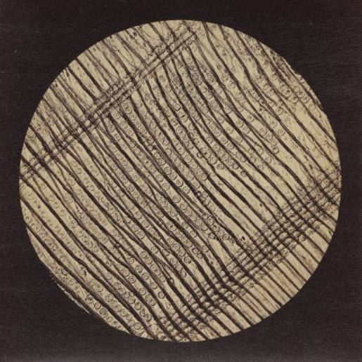 Spruce, Plate XI from 'Blicke durch das Mikroskop' (Views through the Microscope)